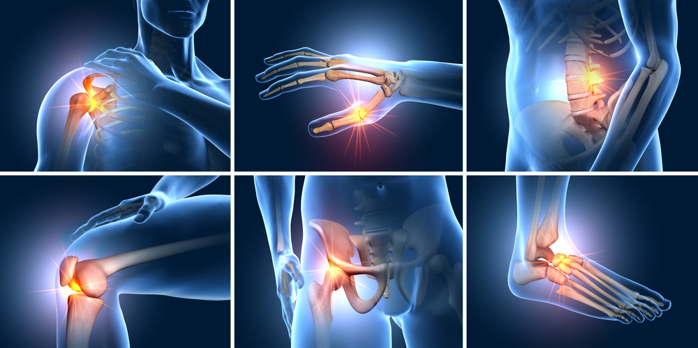 Joint Discomfort